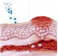 ʪ��߻�����Щ֢״����