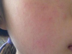 天津哪里看皮炎比较好