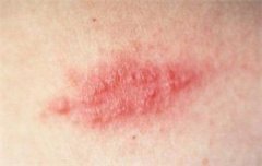 ����״����ҽԺ�ļҺ�