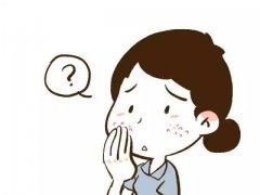 天津市哪里看酒糟鼻