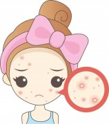天津治青春痘哪里好一点
