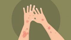 天津治牛皮癣的医院